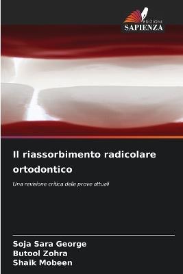 Il riassorbimento radicolare ortodontico - Soja Sara George,Butool Zohra,Shaik Mobeen - cover