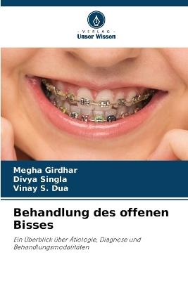 Behandlung des offenen Bisses - Megha Girdhar,Divya Singla,Vinay S Dua - cover