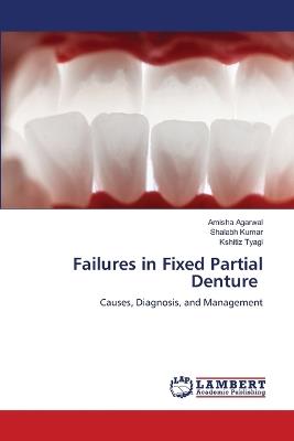 Failures in Fixed Partial Denture - Amisha Agarwal,Shalabh Kumar,Kshitiz Tyagi - cover