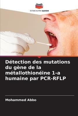 Détection des mutations du gène de la métallothionéine 1-a humaine par PCR-RFLP - Mohammed Abbo - cover