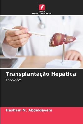 Transplantação Hepática - Hesham M Abdeldayem - cover