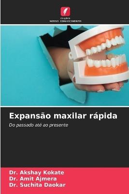 Expansão maxilar rápida - Akshay Kokate,Amit Ajmera,Suchita Daokar - cover