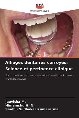Alliages dentaires corroyés: Science et pertinence clinique - Jeevitha M,Himamshu H N,Sindhu Sudhakar Kumararma - cover