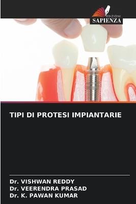 Tipi Di Protesi Impiantarie - Vishwan Reddy,Veerendra Prasad,K Pawan Kumar - cover