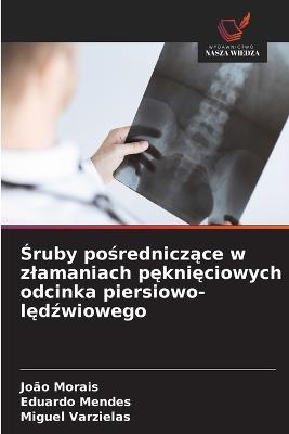 Śruby pośredniczące w zlamaniach pęknięciowych odcinka piersiowo-lędźwiowego - João Morais,Eduardo Mendes,Miguel Varzielas - cover