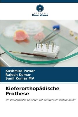 Kieferorthopädische Prothese - Kashmira Pawar,Rajesh Kumar,Sunil Kumar Mv - cover