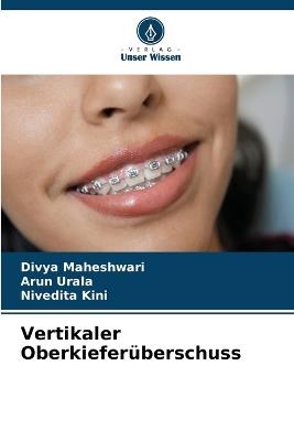 Vertikaler Oberkieferüberschuss - Divya Maheshwari,Arun Urala,Nivedita Kini - cover