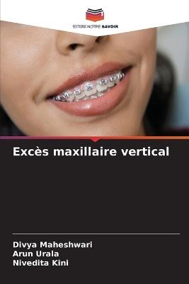 Excès maxillaire vertical - Divya Maheshwari,Arun Urala,Nivedita Kini - cover