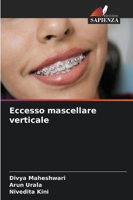 Eccesso mascellare verticale - Divya Maheshwari,Arun Urala,Nivedita Kini - cover