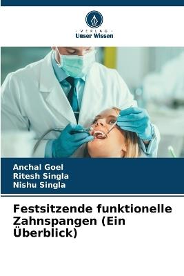 Festsitzende funktionelle Zahnspangen (Ein Überblick) - Anchal Goel,Ritesh Singla,Nishu Singla - cover