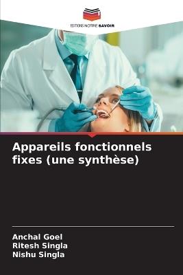 Appareils fonctionnels fixes (une synthèse) - Anchal Goel,Ritesh Singla,Nishu Singla - cover