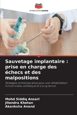 Sauvetage implantaire: prise en charge des échecs et des malpositions - Mohd Siddiq Ansari,Jitendra Khetan,Akanksha Anand - cover