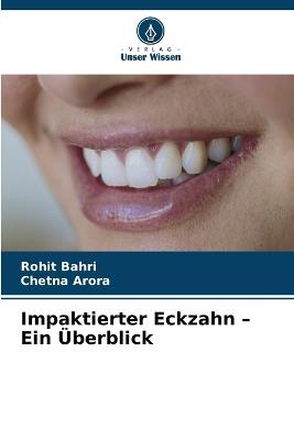 Impaktierter Eckzahn - Ein Überblick - Rohit Bahri,Chetna Arora - cover