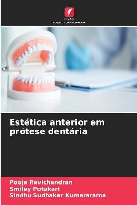 Estética anterior em prótese dentária - Pooja Ravichandran,Smiley Potakari,Sindhu Sudhakar Kumararama - cover