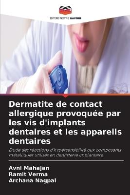 Dermatite de contact allergique provoquée par les vis d'implants dentaires et les appareils dentaires - Avni Mahajan,Ramit Verma,Archana Nagpal - cover