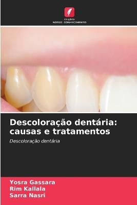 Descoloração dentária: causas e tratamentos - Yosra Gassara,Rim Kallala,Sarra Nasri - cover