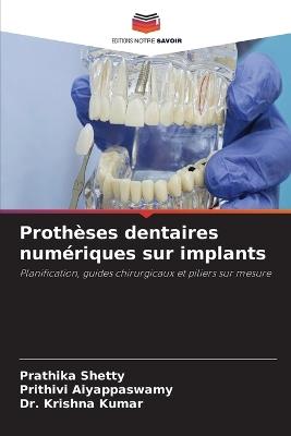 Prothèses dentaires numériques sur implants - Prathika Shetty,Prithivi Aiyappaswamy,Krishna Kumar - cover