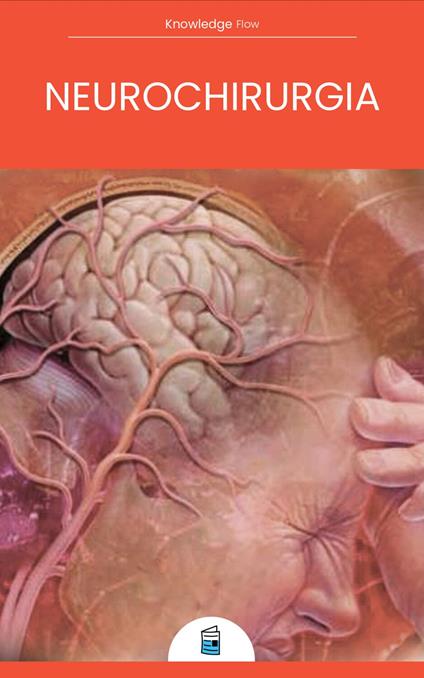 Neurochirurgia - Knowledge flow - ebook