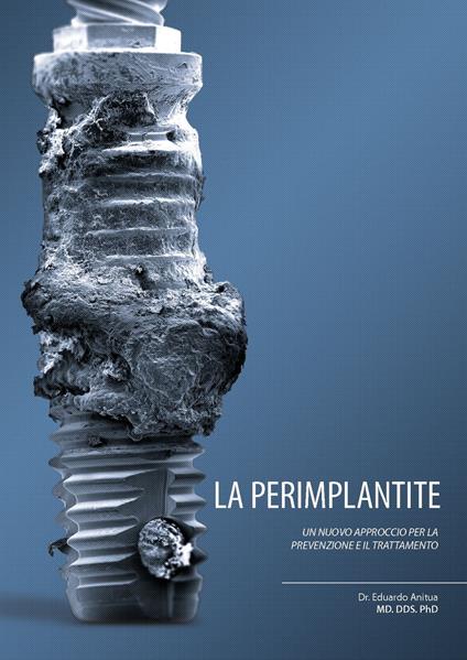 La perimplantite. Un nuovo approccio alla prevenzione e al suo trattamento - Eduardo Anitua Aldecoa - copertina