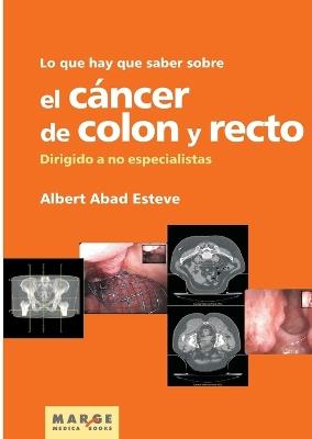 Lo que hay que saber sobre el cáncer de colon y recto - Albert Abad Esteve - cover