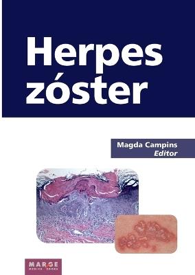 Herpes zóster - Varios autores - cover