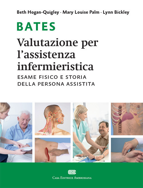 ibs