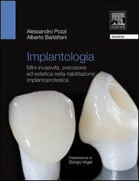 Implantologia. Mini-invasività, precisione ed estetica nella riabilitazione implantoprotesica - Alessandro Pozzi,Alberto Barlattani - copertina