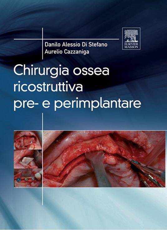 Chirurgia ossea ricostruttiva pre-e perimplantare - Aurelio Cazzaniga,Danilo Alessio Di Stefano - ebook