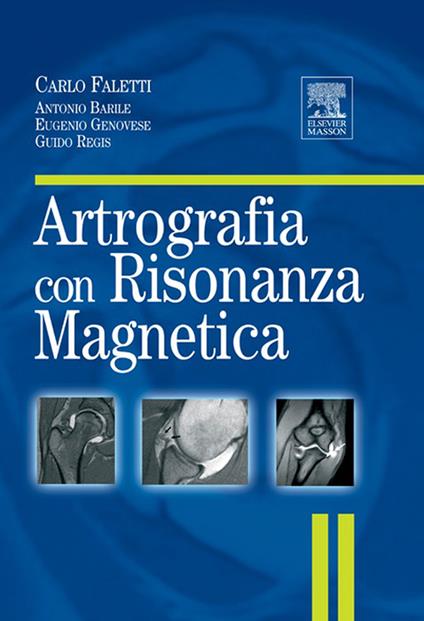 Artrografia con risonanza magnetica - Antonio Barile,Carlo Faletti,Eugenio Genovese,Guido Regis - ebook