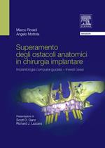 Superamento degli ostacoli anatomici in chirurgia implantare. Implantologia computer-guidata innesti ossei