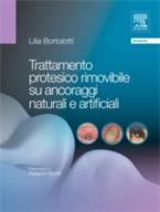 Trattamento protesico rimovibile su ancoraggi naturali e artificiali