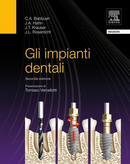 Gli impianti dentali - Charles A. Babbush,J. A. Hahn,J. T. Krauser,J. L. Rosnelicht - ebook