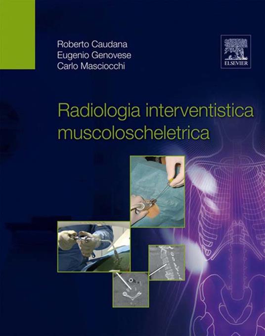 Radiologia interventistica muscoloscheletrica - Roberto Caudana,Eugenio Genovese,Carlo Masciocchi - ebook