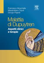 Malattia di Dupuytren. Aspetti clinici