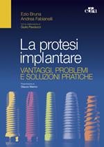 La protesi implantare. Vantaggi, problemi e soluzioni pratiche