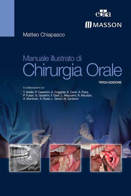 Manuale illustrato di chirurgia orale - Matteo Chiapasco - ebook