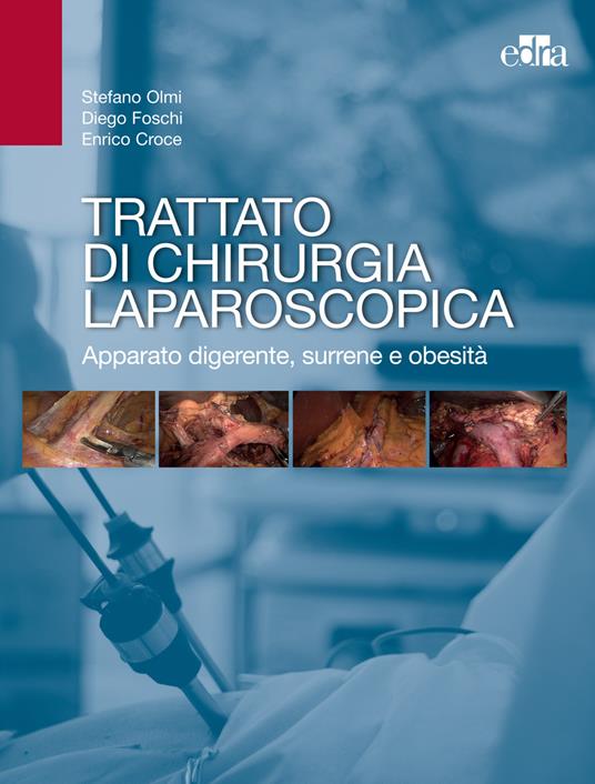 Trattato di chirurgia laparoscopica. Apparato digerente, surrene e obesità - Enrico Croce,Diego Foschi,Stefano Olmi - ebook