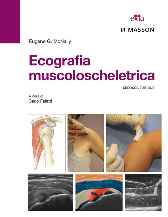 Ecografia muscoloscheletrica. Ediz. illustrata - Eugene G. McNally,Carlo Faletti - ebook