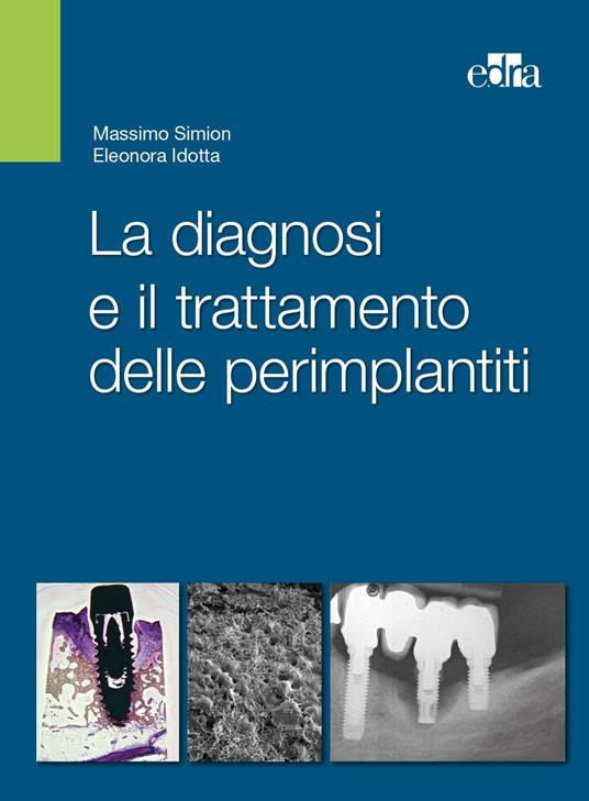 La diagnosi e il trattamento delle perimplantiti - Massimo Simiom,Eleonora Idotta - copertina