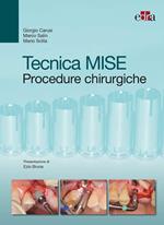 Tecnica MISE. Procedure chirurgiche