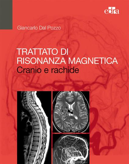 Trattato di risonanza magnetica. Cranio e rachide - Giancarlo Dal Pozzo - copertina