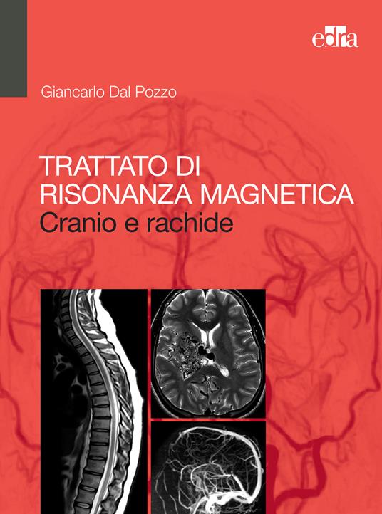 Trattato di risonanza magnetica. Cranio e rachide - Giancarlo Dal Pozzo - ebook
