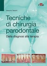 Tecniche di chirurgia parodontale. Dalla diagnosi alla terapia