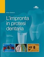 L' impronta in protesi dentaria
