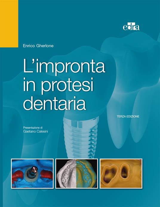L' impronta in protesi dentaria - Enrico F. Gherlone - ebook