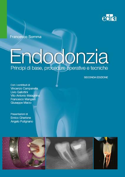 Endodonzia. Principi di base, procedure operative e tecniche - Francesco Somma - ebook