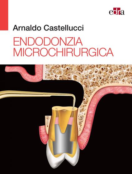 Endodonzia microchirurgica - Arnaldo Castellucci,Elio Berutti,Massimo Gagliani - ebook