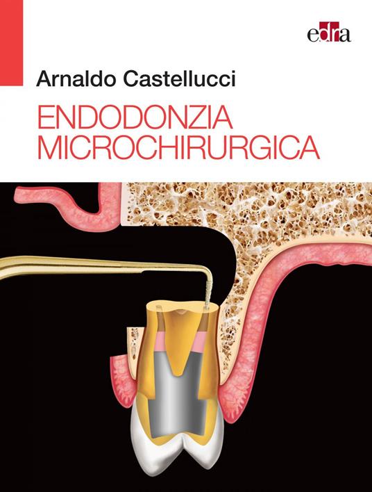 Endodonzia microchirurgica - Arnaldo Castellucci,Elio Berutti,Massimo Gagliani - ebook
