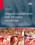 Diagnosi e trattamento delle forcazioni parodontali