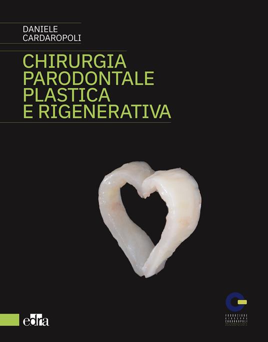 Chirurgia parodontale plastica e rigenerativa - Daniele Cardaropoli - copertina